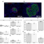 Research Suggests Prenatal Exposure To Cannabis Increases Diabetes Risk In Offspring 3 Research Suggests Prenatal Exposure To Cannabis Increases Diabetes Risk In Offspring