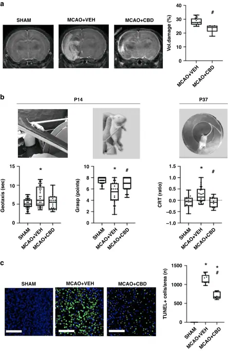 Effects of cannabidiol in post-stroke mood disorders in neonatal rats – Pediatric Research