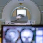 Epilepsy treatment research could bring patients closer to a 'seizure-free' life 3 Epilepsy treatment research could bring patients closer to a ‘seizure-free’ life