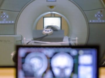 Epilepsy treatment research could bring patients closer to a ‘seizure-free’ life